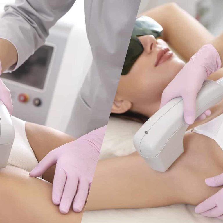 diode-lazer-epilasyon